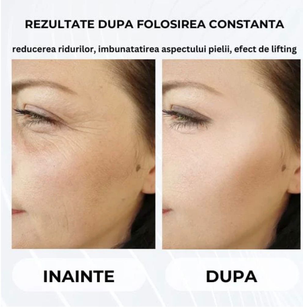Instrument de infrumusetare pentru lifting facial
